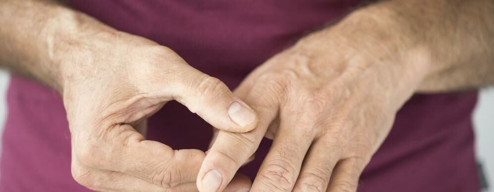 Rheumatoid arthritis, ahol jobb kezelni, Hajlamos-e Ön a rheumatoid arthritisre?